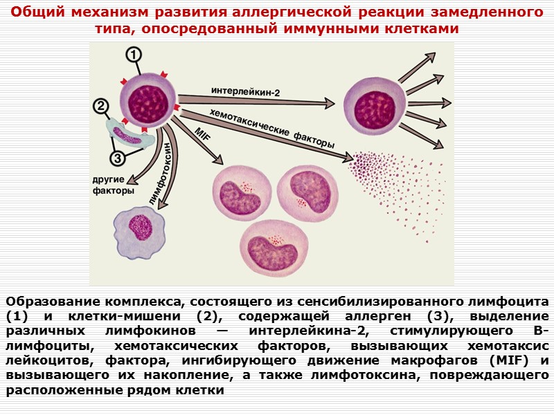 Образование комплекса, состоящего из сенсибилизированного лимфоцита (1) и клетки-мишени (2), содержащей аллерген (3), выделение
